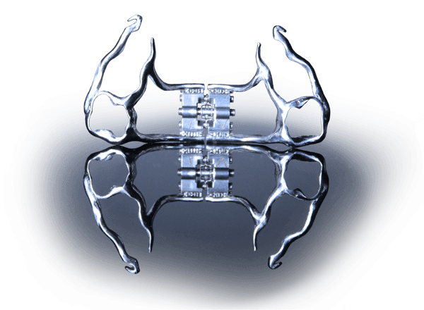 Orthodontie Fixe Disjoncteur Anatomik Anatomique Delaire